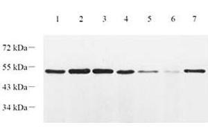 Western blot analysis of EIF2S2 (ABIN7073880) at dilution of 1: 1000,Lane 1: HT29 cell lysate,Lane 2: L1299 cell lysate,Lane 3: CaCO2 cell lysate,Lane 4: Mouse lung tissue lysate,Lane 5: Mouse colon tissue lysate,Lane 6: Mouse small intestine tissue lysate,Lane 7: Rat lung tissue lysate (EIF2S2 抗体)