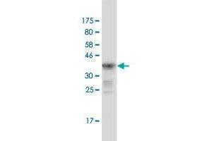 Western Blot detection against Immunogen (36. (MUTYH 抗体  (AA 436-535))
