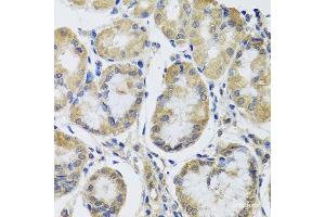 Immunohistochemistry of paraffin-embedded Human stomach using MRPL1 Polyclonal Antibody at dilution of 1:100 (40x lens). (MRPL1 抗体)