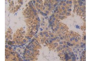 DAB staining on IHC-P; Samples: Mouse Testis Tissue (PKD2 抗体  (AA 327-539))