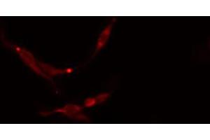 ABIN6273768 staining NIH-3T3 cells by IF/ICC. (MAP2K7 抗体  (Internal Region))