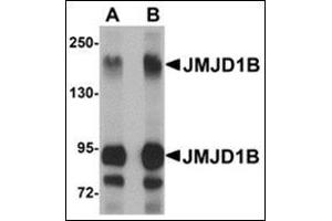 Western blot analysis of JMJD1B in rat liver tissue lysate with this product at (A) 1 and (B) 2 μg/ml. (KDM3B 抗体  (Center))