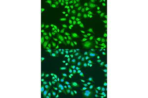 Immunofluorescence analysis of U2OS cells using PAX8 antibody (ABIN1874050) at dilution of 1:100.