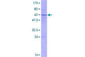 TSSK6 Protein (AA 1-273) (GST tag)