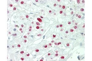 anti-CREB Regulated Transcription Coactivator 1 (CRTC1) antibody