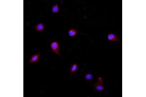 IF analysis of Krt20 using anti-Krt20 antibody (ABIN7601133). (KRT20 抗体  (AA 29-431))