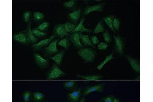 Immunofluorescence analysis of U-2 OS cells using REXO2 Polyclonal Antibody at dilution of 1:100 (40x lens). (REXO2 抗体)
