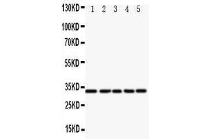 Western Blotting (WB) image for anti-E2F Transcription Factor 6 (E2F6) (AA 162-177), (Middle Region) antibody (ABIN3044189) (E2F6 抗体  (Middle Region))