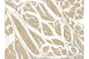 ABIN6258623 and ABIN6273543 at 1/100 staining human tongue carcinoma by IHC-P.