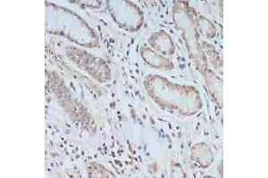 Immunohistochemistry of paraffin-embedded human stomach using TCEB2 antibody (ABIN6131621, ABIN6148934, ABIN6148936 and ABIN6217328) at dilution of 1:100 (40x lens). (TCEB2 抗体  (AA 1-118))