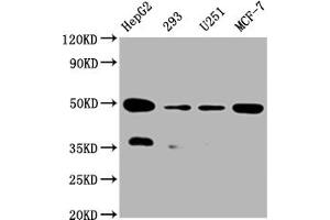 Western Blot Positive WB detected in:HepG2 whole cell lysate, 293 whole cell lysate, U251 whole cell lysate, MCF-7 whole cell lysate All lanes: UQCRC2 antibody at 1:2000 Secondary Goat polyclonal to rabbit IgG at 1/50000 dilution Predicted band size: 49 kDa Observed band size: 49 kDa (Recombinant UQCRC2 抗体)