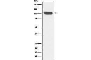 Western blot analysis of ERAP1 expression in K562 cell lysate.