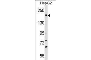 Western blot analysis in HepG2 cell line lysates (35ug/lane). (PNPLA6 抗体  (C-Term))