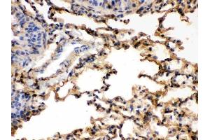 IHC analysis of S100A6 using anti-S100A6 antibody (ABIN3043320).