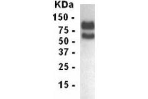 Western Blotting (WB) image for anti-Low Density Lipoprotein Receptor (LDLR) (AA 29-205) antibody (ABIN2467854) (LDLR 抗体  (AA 29-205))