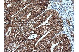 Image no. 2 for anti-Mitogen-Activated Protein Kinase Kinase 1 (MAP2K1) antibody (ABIN1499375) (MEK1 抗体)