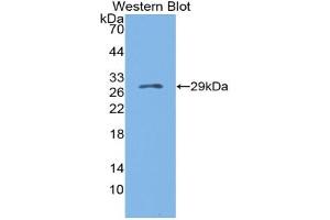 Western blot analysis of the recombinant protein. (Granulin 抗体  (AA 31-269))