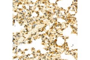 Immunohistochemistry (Paraffin-embedded Sections) (IHC (p)) image for anti-Protein Tyrosine Phosphatase G1 (PTPN12) antibody (ABIN7075292)