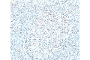 Immunohistochemistry (IHC) image for anti-Enhancer of Zeste Homolog 2 (EZH2) (AA 1-154) antibody (ABIN7795766)