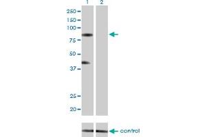 Western blot analysis of RNF103 over-expressed 293 cell line, cotransfected with RNF103 Validated Chimera RNAi (Lane 2) or non-transfected control (Lane 1). (RNF103 抗体  (AA 501-599))