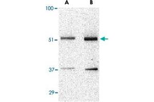 Western blot analysis of TANK in Daudi cell lysate with TANK polyclonal antibody  at (A) 0. (TANK 抗体  (N-Term))