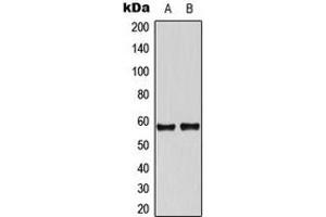 Western blot analysis of Tyrosine Hydroxylase expression in A549 (A), NIH3T3 (B) whole cell lysates.