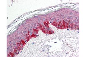 Anti-STK11 / LKB1 antibody IHC of human skin. (LKB1 抗体  (N-Term))