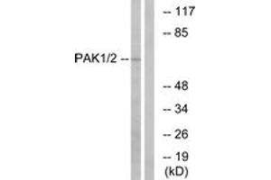 Western blot analysis of extracts from K562 cells, using PAK1/2 (Ab-199) Antibody. (PAK1/2 抗体  (AA 165-214))