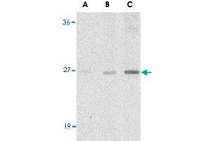 Western blot analysis of C1QTNF7 in NIH/3T3 cell lysate with C1QTNF7 polyclonal antibody  at (A) 1, (B) 2, and (C) 4 ug/mL . (CTRP7 抗体  (N-Term))