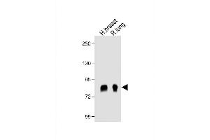 All lanes : Anti- POSTN Antibody (C-term) at 1:1000 dilution Lane 1: human breast lysate Lane 2: rat lung lysate Lysates/proteins at 20 μg per lane. (Periostin 抗体  (C-Term))