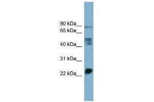 MPZL1 antibody used at 1 ug/ml to detect target protein. (MPZL1 抗体  (Middle Region))