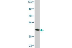 Western Blot detection against Immunogen (37.