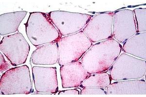 Human Skeletal Muscle: Formalin-Fixed, Paraffin-Embedded (FFPE) (PPP1R13L 抗体  (AA 75-125))