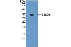 Detection of Recombinant EXO1, Mouse using Polyclonal Antibody to Exonuclease 1 (EXO1) (Exonuclease 1 抗体  (AA 1-250))
