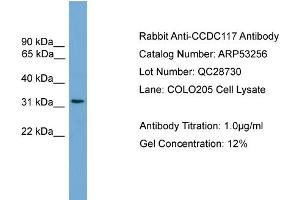 WB Suggested Anti-CCDC117  Antibody Titration: 0. (CCDC117 抗体  (Middle Region))
