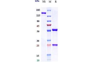 Anti-IL-6 / IFNb2 Reference Antibody (olokizumab) on SDS-PAGE under reducing (R) condition. (Recombinant IL6 (Olokizumab Biosimilar) 抗体)