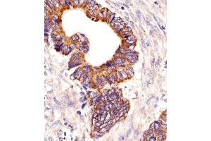 Immunohistochemical analysis of paraffin-embedded H. (PCSK9 抗体  (N-Term))
