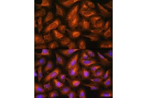 Immunofluorescence analysis of U2OS cells using EIF2B4 Rabbit pAb (ABIN7267037) at dilution of 1:100.