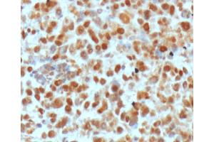 Image no. 3 for anti-DNA Repair Protein Apurinic Endonuclease antibody (ABIN5693483) (DNA Repair Protein Apurinic Endonuclease 抗体)