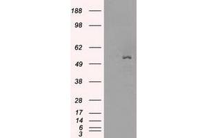 Image no. 4 for anti-Solute Carrier Family 2 (Facilitated Glucose/fructose Transporter), Member 5 (SLC2A5) antibody (ABIN1498477) (SLC2A5 抗体)