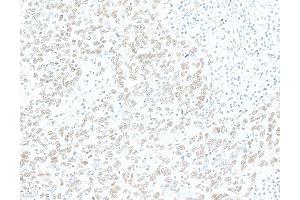 Immunohistochemistry (IHC) image for anti-Zinc Finger CCCH-Type Containing 4 (ZC3H4) (AA 1050-1100) antibody (ABIN7795760)