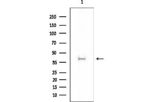 anti-Docking Protein 4 (DOK4) (N-Term) antibody