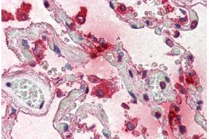 Human Lung (formalin-fixed, paraffin-embedded) stained with TPSAB1 antibody ABIN337204 at 5 ug/ml followed by biotinylated anti-mouse IgG secondary antibody ABIN481714, alkaline phosphatase-streptavidin and chromogen. (TPSAB1 抗体)