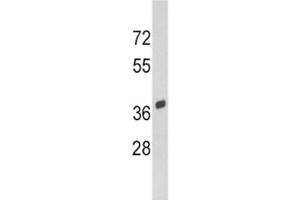 Western blot analysis of SPARC antibody and Y79 lysate. (SPARC 抗体  (AA 224-251))