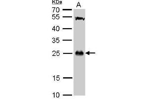 Western Blotting (WB) image for anti-Glutathione S-Transferase theta 1 (GSTT1) antibody (ABIN2856663)