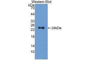 Western Blotting (WB) image for anti-Slit Homolog 2 (Drosophila) (SLIT2) (AA 1160-1333) antibody (ABIN1173398) (SLIT2 抗体  (AA 1160-1333))