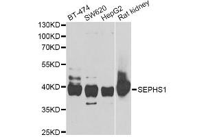 Western blot analysis of extracts of various cell lines, using SEPHS1 antibody (ABIN5973853) at 1/1000 dilution. (SEPHS1 抗体)