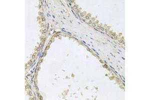 Immunohistochemistry of paraffin-embedded human prostate using POMGNT1 antibody (ABIN6003611) at dilution of 1/100 (40x lens).