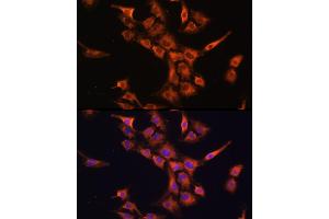 Immunofluorescence analysis of C6 cells using PFDN5 Rabbit pAb (ABIN1681328, ABIN3018415, ABIN3018416 and ABIN6220463) at dilution of 1:100 (40x lens). (PFDN5 抗体  (AA 1-154))