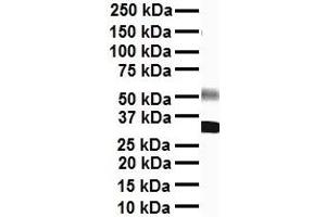 Western Blotting (WB) image for anti-Sodium Channel, Voltage-Gated, Type VIII, alpha (SCN8A) (C-Term) antibody (ABIN2776200)